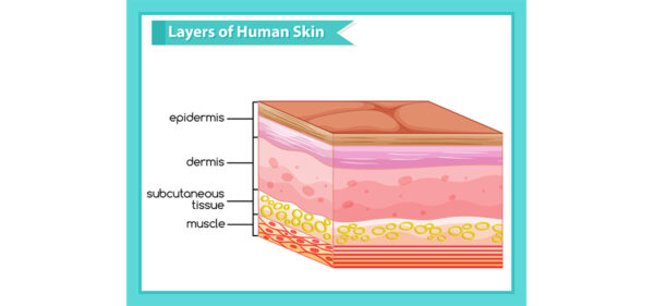 Skin layers and the main causes of skin dryness and scaling – Farachem